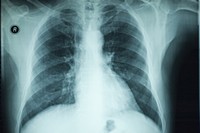 transparent_radiology.jpg